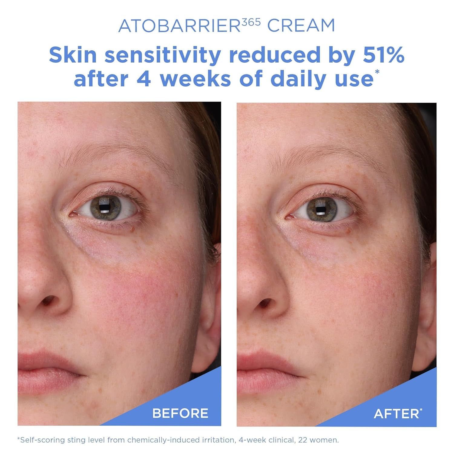 ATOBARRIER365 Cream with Ceramide, Korean Moisturizer for Barrier Repair | 120-Hour Lasting Hydration, Capsuled Ceramides for Dry & Sensitive Skin, Non-Comedogenic Tested, 2.70 Fl.Oz.(Renewed)